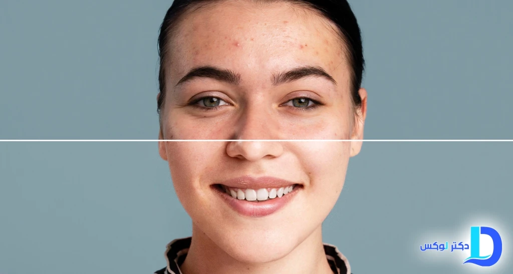 پوست شیشه‌ای در 4 شب | روتین علمی بازسازی پوست با رتینول